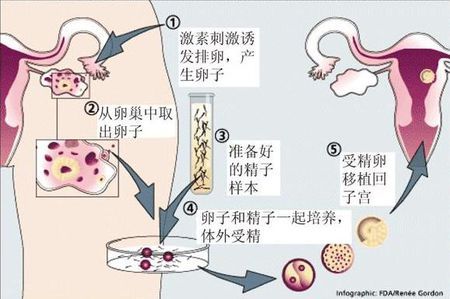 关于素竹生殖